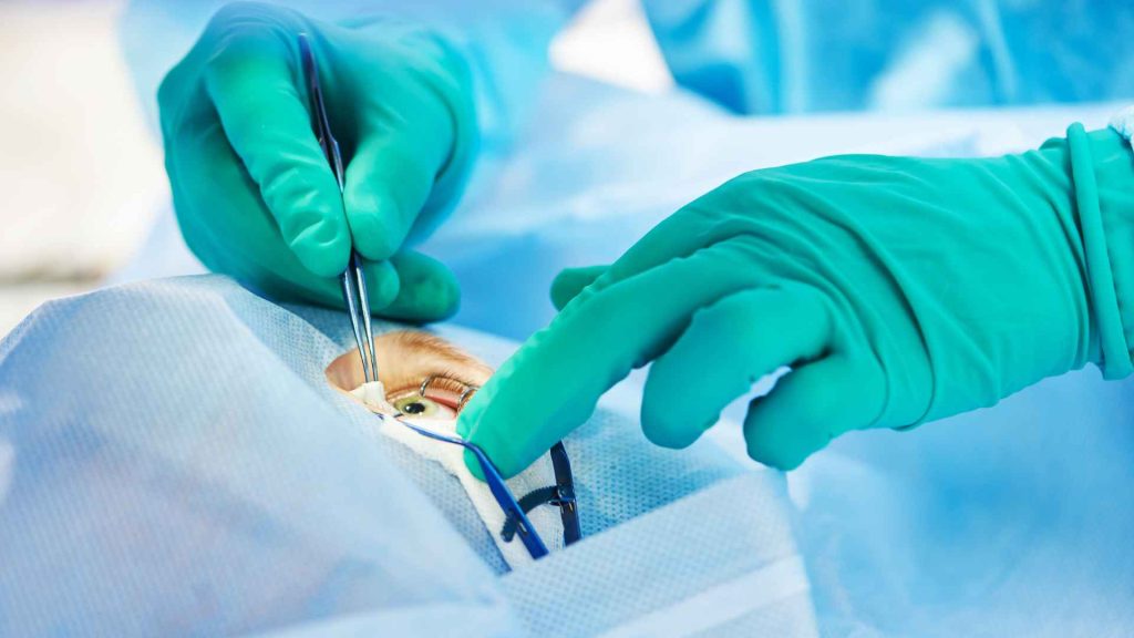 Eye Research Project